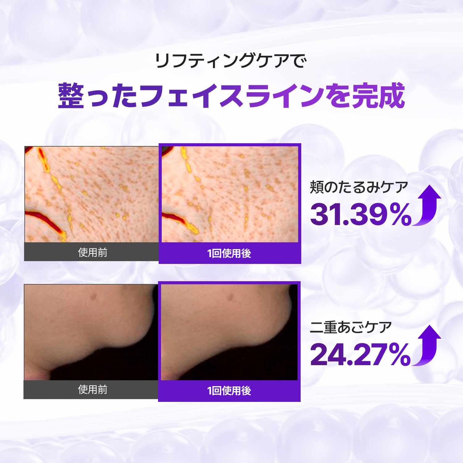 VEGANIFECT（ヴィーガンイフェクト公式） コラーゲンフルフェイスリフティングマスク上用20ml/下用25ml［マスク3ea+Vバンド1ea］